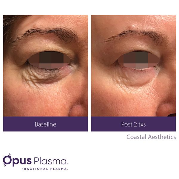 Opus Before After B2B Web Coastal Aesthetics